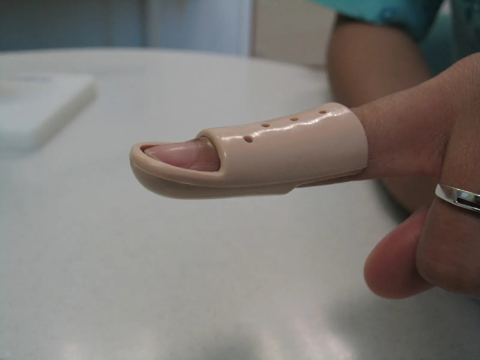 Mallet Splint